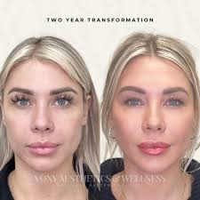 Luxury Anti-aging & Longevity Clinic in Rogers, AR