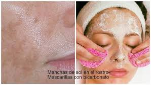 Puedes usar un procedimiento llamado luz pulsada intensa o un fotofacial para tratar no solo las manchas blancas, sino también toda la zona de piel dañada por el sol y para dar lugar a un tono de piel más uniforme. Mascarilla De Bicarbonato Para Quitar Las Manchas De Sol Mascarilla Para Quitar Manchas Recetas De Belleza Manchas En La Cara