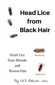 Pin On Lice Pictures How To Check For Lice