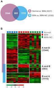 The most common type of bladder cancer is transitional cell carcinoma, also called urothelial carcinoma. Plos One Identification Of Gene Expression Signature Modulated By Nicotinamide In A Mouse Bladder Cancer Model