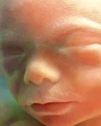 The Value of Human Life from Conception