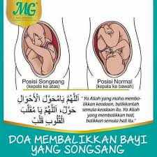 Namun, menurut american pregnancy association terdapat banyak kemungkinan risiko ibu hamil memiliki bayi sungsang. Mommy Berkerjaya Hamil Dan Menyusu Bayi Songsang 5 Tips Bantu Anda Atasi Bayi Songsang Memang Merisaukan Ibu Hamil Kalau Boleh Memang Tak Nak Bayi Songsang Bukan Apa Takut Kena Lahirkan