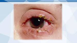 Image result for Blepharis sol