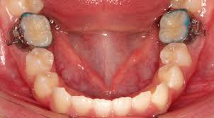 大宮SHIN矯正歯科