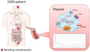 Image result for Platelet Dysfunction