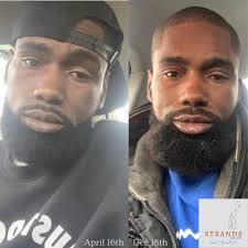 Up to 70% of men can unknowingly carry bacteria and fungus under their  facial hair! That's Beards, Goatees, mustaches, even 5 o clock shadows! WE  HAVE A SOLUTION! MANLY MAN BEARD OIL