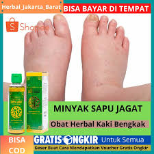 Selain mudah dijumpai khasiat dari beberapa tanaman ini juga tidak diragukan lagi. Obat Kaki Tiba Tiba Membengkak Sehabis Jatuh Luka Kaki Bengkak Akibat Keseleo Minyak Sapu Jagat Shopee Indonesia