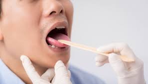 Dikutip himedik dari reader's digest, jason abramowitz, md, dari ent & allergy associates di new york. Sakit Tenggorokan Dan 4 Hal Ini Adalah Ciri Kanker Lidah Gaya Tempo Co