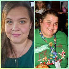 How is this real life?? So thankful for this process. Starting weight: 345  Surgery weight: 295 (9/29/25) Current weight: 255