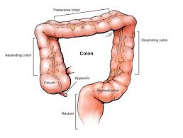 Image result for Colorectal Cancer