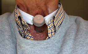 Check spelling or type a new query. Symptomes Du Cancer De La Gorge Detective Sante Le Blog