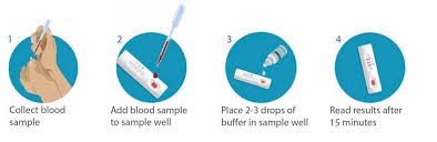 Bd Biomedomics Announce Launch Of Rapid Serology Test To Detect Exposure To Covid 19