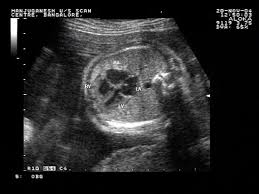 A Gallery Of High Resolution Ultrasound Color Doppler 3d Images Fetal Heart Fetal Ultrasound Image Find the perfect fetal heart monitor stock photo. fetal ultrasound