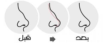 يمكنك تغير السوستة، أو شراء بخاخ جديد ووضعه في زجاجة العطر. Ø§Ù†ÙˆØ§Ø¹ Ø¨Ø®Ø§Ø® Ø§Ù„Ø§Ù†Ù ÙˆØ¯ÙˆØ§Ø¹ÙŠ Ø§Ø³ØªØ®Ø¯Ø§Ù…Ù‡ ÙˆÙƒÙŠÙÙŠØ© Ø§Ø³ØªØ®Ø¯Ø§Ù…Ù‡ Ø§Ù„Ø·Ø¨ÙŠ