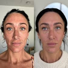 Danielle Mathers, RN, BSN, CANS