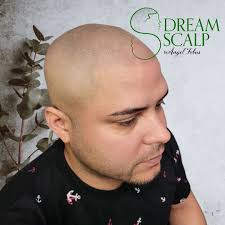 Profile for Dream Scalp