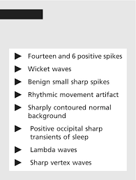 Image result for Sharp CBT-55