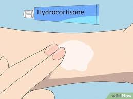 Hydrocortisone cream is a topical medication that can reduce inflammation and itching. 11 Ways To Get Rid Of A Mosquito Bite Wikihow