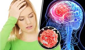 But most breast lumps are caused. Health Cancer Warning Does Your Head Feel Like This Unusual Warning Signs Of Brain Tumours Cancer