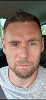 Wishaw dad's nose had to be removed after skin cancer diagnosis