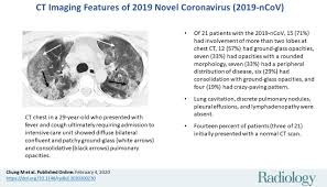 CT Imaging Features of 2019 Novel Coronavirus (2019-nCoV)Radiology