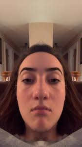 Discovering My Facial Asymmetry