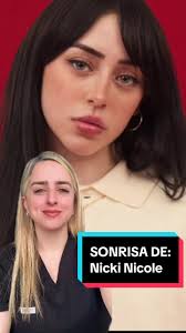 La Sonrisa Perfecta de Nicki Nicole: Análisis y Diseño en Odontología  Estética