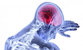 Diagnosticul sclerozei multiple se prezintă în prezența remisiilor și exacerbărilor, cel puțin 2 tulburări neurologice selectate local , identificate clinic sau instrumental, modificări ale rmn sau alte criterii (în. Scleroza MultiplÄƒ DiagnosticatÄƒ GreÈ™it In 20 Din Cazuri Simptomele Care Ii PÄƒcÄƒlesc Pe Medici Dcmedical Ro