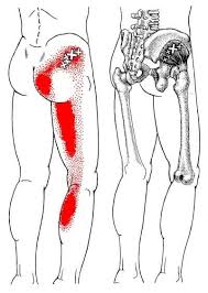 The Definitive Guide To Gluteus Medius Anatomy Exercises Rehab