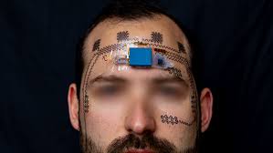 A Mind Trick May Help Advance Prosthetics