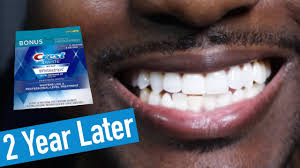 Maybe you would like to learn more about one of these? Crest 3d Whitestrips 2 Years Later How To Whiten Teeth Easy Youtube