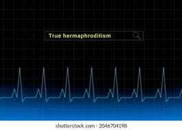 Image result for True Hermaphroditism