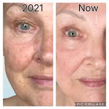 I hear people taking collagen for more protein to add to their coffee  instead of protein powder. Has anyone tried it? How does it taste? Also is  it good for weight loss?