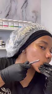 Achieve Smooth Skin with Dermaplaning in Atlanta