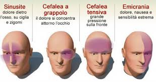 Tutti I Tipi Di Mal Di Testa E Come Alleviarli In Pochissimi Minuti