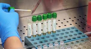Coronavirus De Donno La Plasmaterapia E Efficace Sicura E Poco Costosa