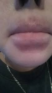 To many people the hickey is some sort of love marking that rep. How To Cover A Bruse Hickey Hellp So Embarrassing Beautylish