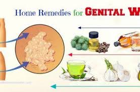 21 Most Effective Home Remedies For Genital Warts In Males Females In 2020 Home Remedies Remedies Warts
