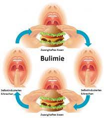 Bulimie Ursachen Beschwerden Therapie Gesundpedia De