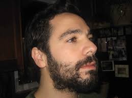 The are several medical conditions that could be the cause. How To Grow Facial Hair Beards Grooming Styling Shaving Tips For Men