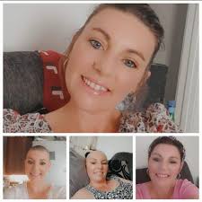 After 6 months in a baseball cap today there was enough hair growth back to  finally get some sort of a style. I haven't had hair this short since my  20s! Thanks