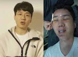 관리자 실수, 심려끼쳐 죄송 해명 전문. ì—¬í˜ ë‚™ì¸ ìœ íŠœë²„ ë³´ê²¸ 8ì‹œê°„ ì„±í˜• ì˜ˆì „ ì–¼êµ´ ì•„ì˜ˆ ì—†ì–´ì¡Œë‹¤