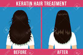 Hair Care Before And After Keratin Treatment Split Ends Damaged Royalty Free Cliparts Vectors And Stock Illustration Image 113022452