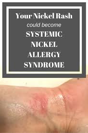 We did not find results for: Your Nickel Rash Could Become Systemic Nickel Allergy Syndrome