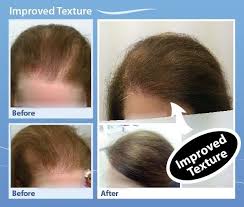 Like any other part of the body, your hair also needs vitamins to be healthy and grow uninterrupted. Healthier Thicker Fuller Hair Using Help Hair Shake And Hair Vitamins All Natural Protein For Thinning Hair For Hair Vitamins Hair Loss Hair Growth For Men