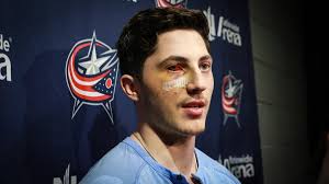 Colton Howard (@lee_hawarrrd)