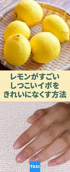 レモンを使ってしつこいイボを綺麗に取り除く方法 イボ イボが取れるオイル イボ取り レモン 手作りイボ取り 手足 首 イボ 一度できるとなかなかしつこいイボ その多くがウイルス性の良性のものと言われれ 皮膚科での治療が行われます しかし時には治療を