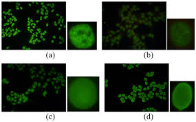 Image result for ANA Staining Pattern