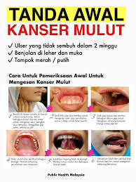 Check spelling or type a new query. Kanser Mulut Adalah Satu Keadaan Public Health Malaysia Facebook