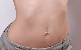 Damit keine darmschlingen absterben, muss sofort eine operation erfolgen. Kinderwunsch Soll Ich Vor Der Schwangerschaft Meinen Bauchnabel Operieren Lassen Gesundheit Und Medizin Schwanger Mutter